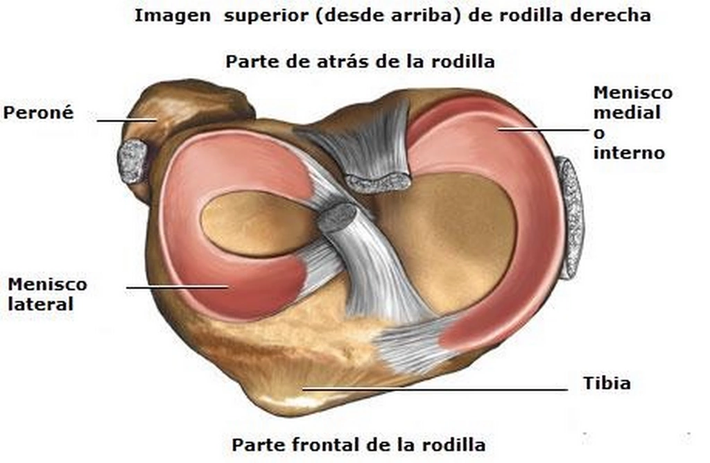 Qué es la meniscopatía: clínica y tratamiento